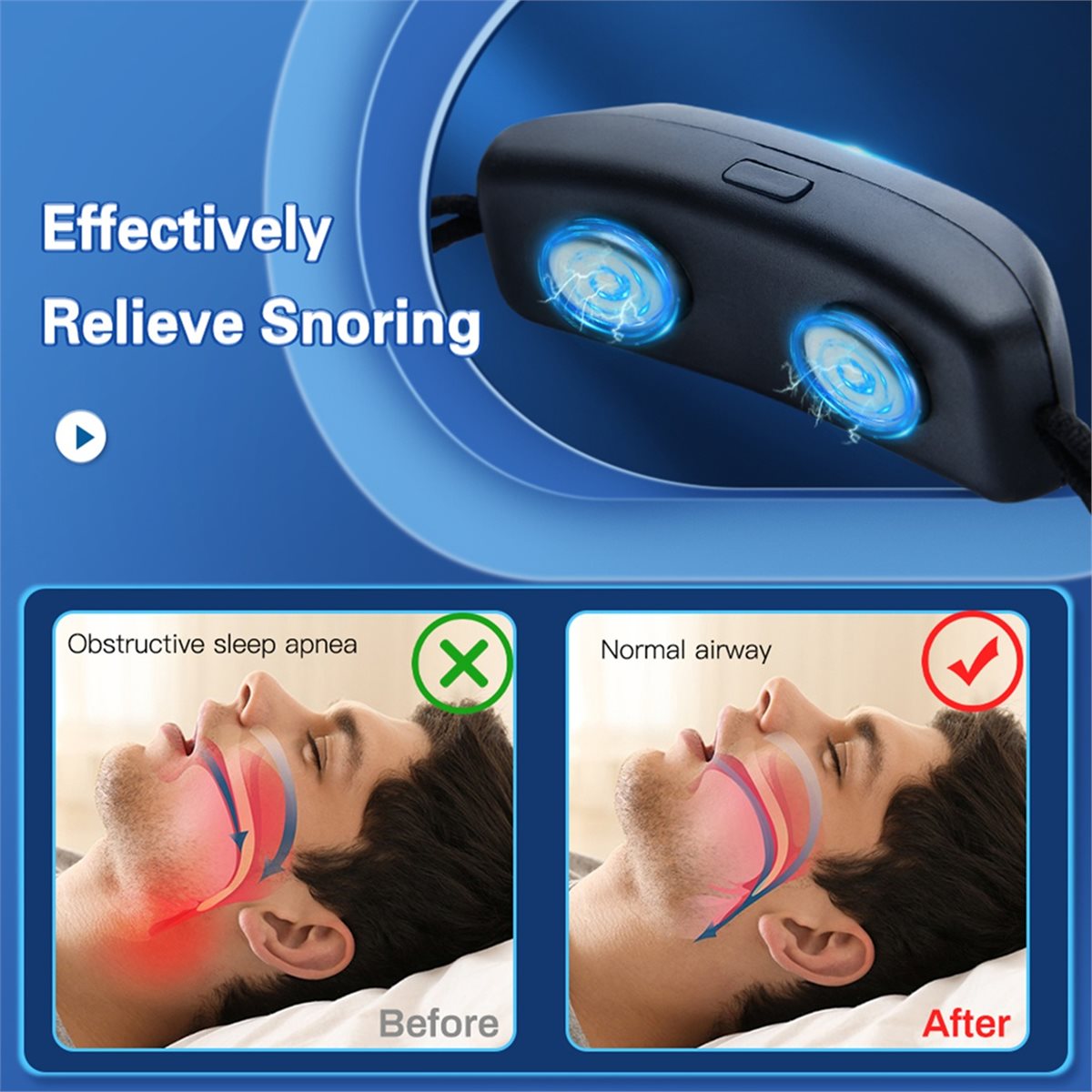 Trend Health And Wellness - อุปกรณ์ป้องกันการกรนแบบพกพา EMS Pulse รุ่น 2026 ช่วยให้นอนหลับสบาย